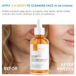 Retinol Serum Manufacturer - Niacinamide Private Label - Anti Aging Retinol Buffet