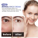 Whitening Cream Manufacturer - Niacinamide Glutathione - Dark Spots Skin Brightening