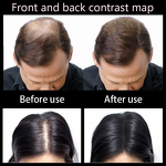 Hair Growth Oil Manufacturer - Customized Private Label Pure Essential Oils Rosemary