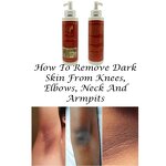 Knuckle Remover Body Cream Manufacturer - Intense Whiten Stubborn Dark Knuckles Elbows Knees Ankles Toes