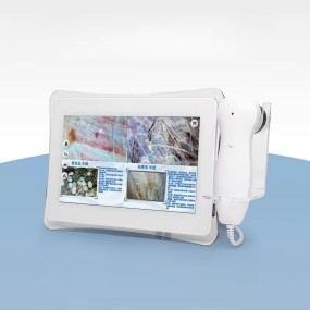 Hair Scalp Scanner Supplier - Touch Screen Analysis Machine