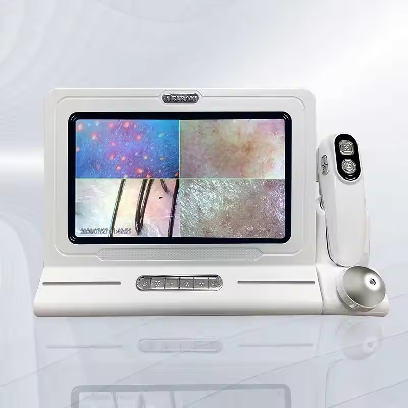 Hair Follicle Scanner Manufacturer - HD Scalp Detector Analysis