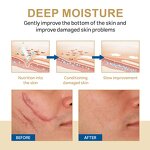 Peeling Oil Manufacturer - OEM ODM Custom Extra Strong for Body Skin Whitening Stretch Marks Remover