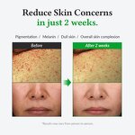 Teeth Whitening Pen Manufacturer - OEM Custom Fast Stain Removal for Coffee Tea Smoking Teeth