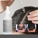 Blackhead Removal Serum Manufacturer - Private Label Green Tea Camellia Pore Shrinking Anti-Acne