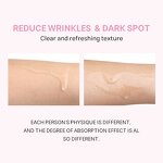 Collagen Threads Manufacturer - Custom Logo Soluble Face Line Protein - Reduce Fine Lines Wrinkle Tightening