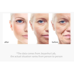 Cream Manufacturer - OEM Best Selling Herbal Spot Blemish Freckle Removal Anti-Wrinkle Whitening Cream