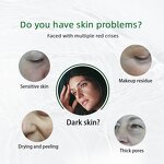 Face Serum Manufacturer - Red Blood Spot Corrector Private Label Natural Acne Scar Removal Treatment