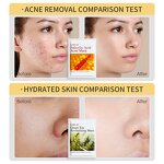 Facial Mask Manufacturer - OEM ODM Custom - Organic Whitening Anti-aging Face Body