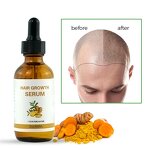 Hair Oil Manufacturer - Private Label - Anti Hair Loss Fast Growth Hot Sale