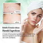 Toner Manufacturer - Houttuynia Cordata for Acne Soothing Sensitivity & OEM Hot