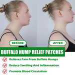 Care Patch Manufacturer - for Frozen Shoulder Hunchback Lumbar Cervical Mugwort