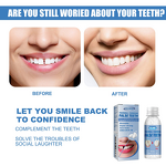 Teeth Whitening Accessories Manufacturer - Multifunctional Gel Film for Cavity Gap Filling