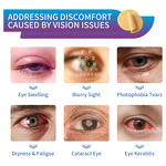 Eye Care Patches Manufacturer - Herbal for Dry Eyes Fatigue Relief Sleep-Protective Gel