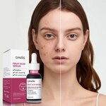 Essence Serum Manufacturer - Acid Fruit for Acne Removal Softening Cuticles