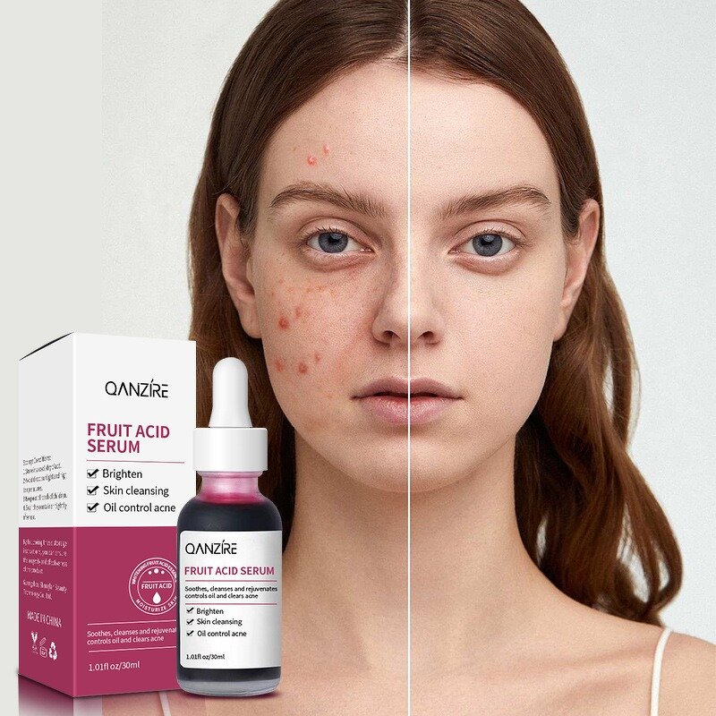 Essence Serum Manufacturer - Acid Fruit for Acne Removal Softening Cuticles