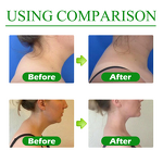 Care Patch Manufacturer - for Frozen Shoulder Hunchback Lumbar Cervical Mugwort