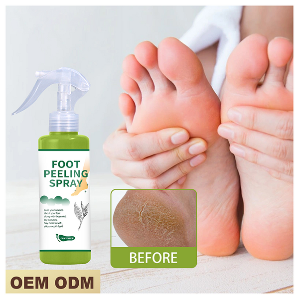Foot Spray Manufacturer - Collagen Infused - Tea Tree Oil Exfoliating Repair Dead Skin Calluses Black Skin