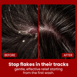 Hair Growth Shampoo Manufacturer - Christmas Limited Edition - Argan Oil Biotin Soothe Scalp Anti Dandruff Reduce Hair Fall