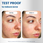 Facial Cleanser Manufacturer - Blue Copper Peptide - Organic Ghk-Cu Hyaluronic Acid Anti Aging Wrinkle Care