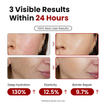 Face Lotion Manufacturer - Christmas Limited Edition - Sensitive Skin Soothing Repair Hyaluronic Acid