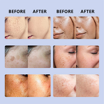 Face Cream Manufacturer - Blue Copper Peptide - Hyaluronic Acid Brightens Dark Skin Anti Wrinkle Repairing