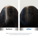 Hair Growth Oil Manufacturer - Natural - Ghk-Cu Blue Copper Peptide Hyaluronic Acid Damaged Hair Repair