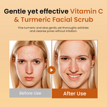 Facial Scrub Manufacturer - Brightening Turmeric Vitamin C - Avocado Oil Vitamin E Aloe Vera Acne Prone