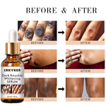 Serum Manufacturer - Dark Knuckles Fast Whitening - Allantoin Niacinamide Elastic Smooth Knee Repair