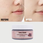 Facial Mask Manufacturer - OEM Carbonated Bubble - Anti Acne Anti Wrinkle Pore Cleaner Collagen Hyaluronic Acid