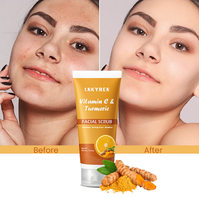 Facial Scrub Manufacturer - Brightening Turmeric Vitamin C - Avocado Oil Vitamin E Aloe Vera Acne Prone
