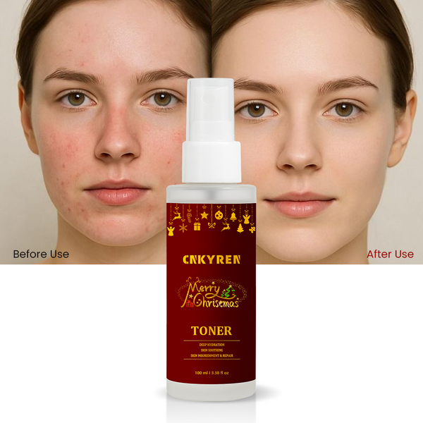 Facial Toner Spray Manufacturer - Christmas Limited Edition - Jojoba Seed Oil Sensitive Skin Soothing Refreshing