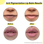 Lip Sleeping Mask Manufacturer - Korean Repairing Lip Lines with Hyaluronic Acid Retinol Cute Nourishing Balm & OEM