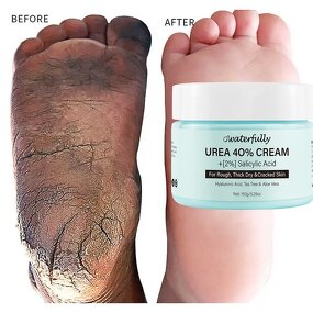 Foot Cream Manufacturer - Moisturizing Custom Moisture Organic for Cracked Heels & OEM