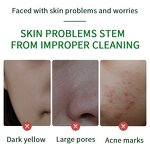 Handmade Soap Manufacturer - Herbal Faint Scent Argy Wormwood Extect Skin Whitening Nourishing & Custom Private Label Hot Selling