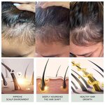 Hair Growth Oil Manufacturer - Rosemary Herbal Vegan Hair Loss Treatment with Mint & Manufacturer