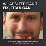 Eye Gel Manufacturer - 2025 OEM Vegan Korean Peptide Anti-aging Wrinkles Bags Removal for Men