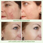 Face Care Cream Manufacturer - Korean Glass Skin Reduce Wrinkles Deep Hydration with Amla & OEM