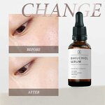 Bakuchiol Serum Manufacturer - Organic Retinol Anti Aging Anti-wrinkles Natural Face Serum & OEM 2025