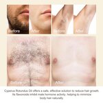 Essential Oil Manufacturer - 50ml 100% Pure Natural Cold Pressed Cyperus Rotundus for Hair Removal & Wholesale