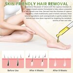 Essential Oil Manufacturer - 50ml 100% Pure Natural Cold Pressed Cyperus Rotundus for Hair Removal & Wholesale