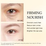Eye Cream Manufacturer - Firming with Collagen Vitamin C Hyaluronic Acid & OEM/ODM