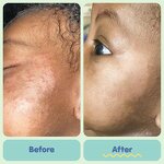 Baby Balm Manufacturer - Natural Soothing Itch Nappy Diaper Rash Whitening Rash Cream & OEM Private Label Factory Price