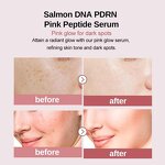 Peptide Serum Manufacturer - PDRN Pink with Niacinamide Hydrating for Dark Spots & Private Label Korean