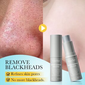 Eye Cream Manufacturer - Wrinkle Firming Dark Circles Hot Selling Private Labels Snail Eye Bags Removal Cream