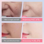 Tanning Spray Manufacturer - Spray Lanthome Oem Odm Wholesale Self Home Professional Sunless Nasal Mist Face Tan