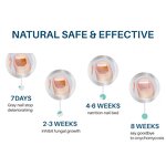 Acne Patches Manufacturer - Cover Patch Private Label 72pcs Hydrocolloid Anti Acne Removal Healing