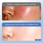 Skin Care Set Manufacturer - Himalayan Pink Salt Pore Tightening Moisturizing Essence