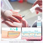 Nail Treatment Manufacturer - Paronychia Onychomycosis Feet Care Nail Foot Whitening Toe Fungus Removal Gel