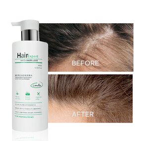 Shampoo Manufacturer - Custom 400ml Natural with Turmeric Black Tea Improves Scalp Anti-Hair Loss